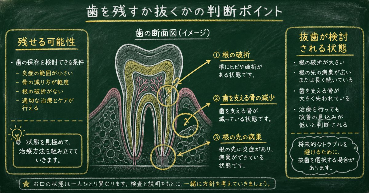 抜歯を勧められた際に知っておきたい残せる可能性と判断の基準