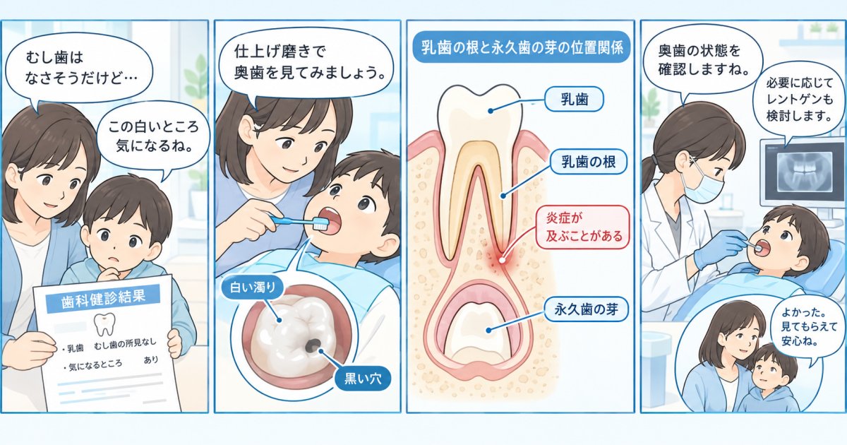 子どもの乳歯のむし歯を放置したら永久歯に影響？受診を迷う親へ