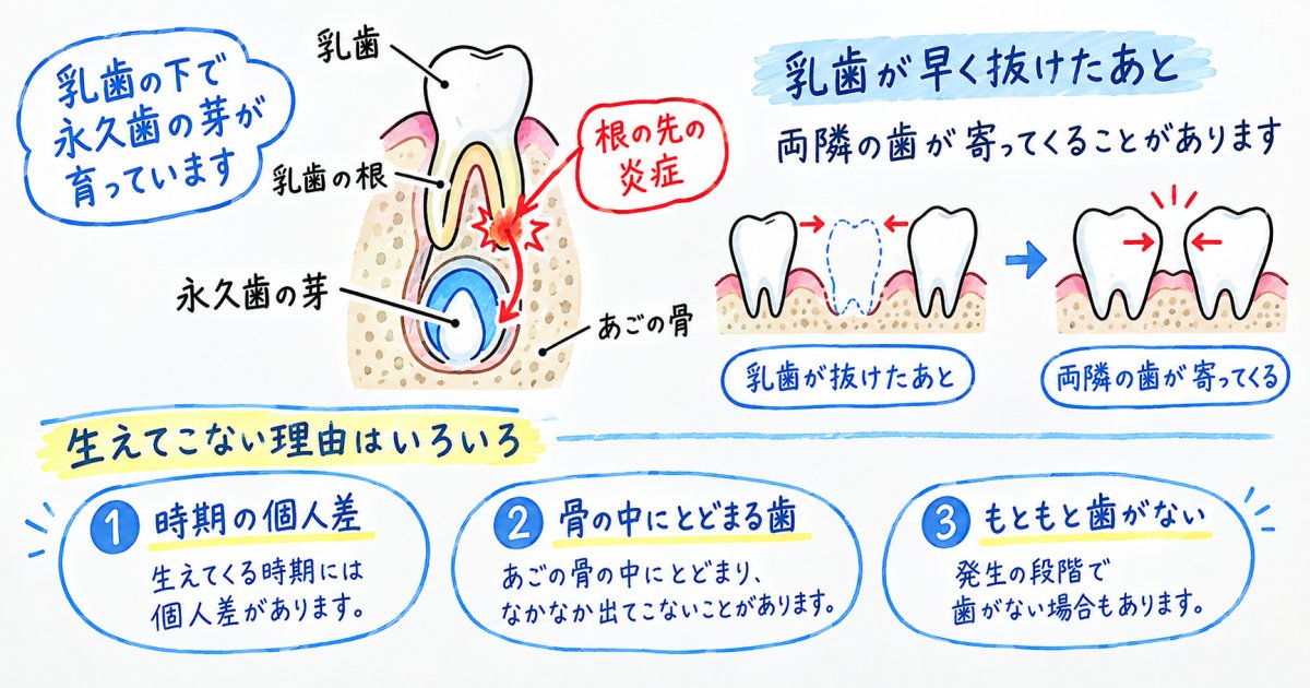 乳歯のむし歯を放置すると、永久歯に何が起こり得る？
