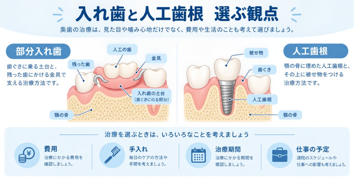 入れ歯と人工歯根、どっち？仕事と家計に合う奥歯の治療選び